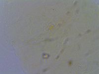 Echiniscus quadrispinosus image