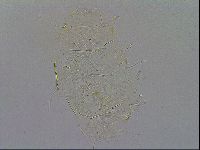 Echiniscus quadrispinosus image