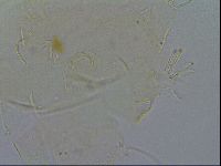 Echiniscus quadrispinosus image