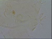 Echiniscus quadrispinosus image