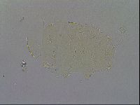 Echiniscus quadrispinosus image