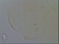 Echiniscus quadrispinosus image