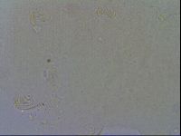 Echiniscus quadrispinosus image