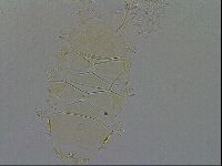 Echiniscus quadrispinosus image