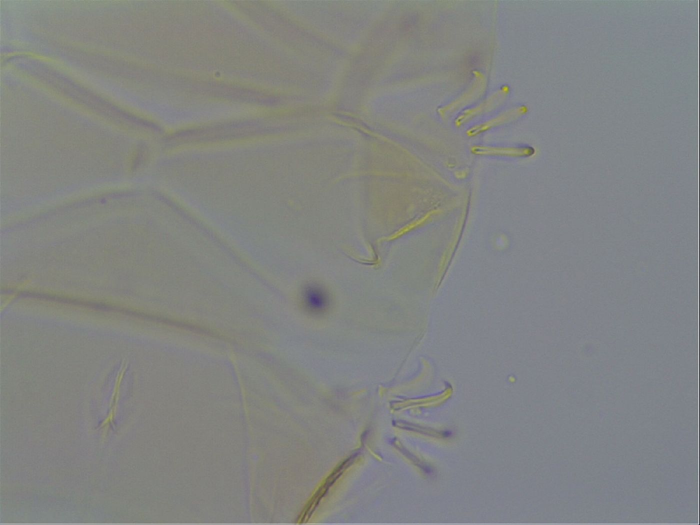 Echiniscus quadrispinosus image