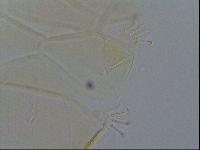Echiniscus quadrispinosus image