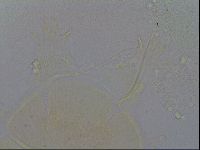 Echiniscus quadrispinosus image