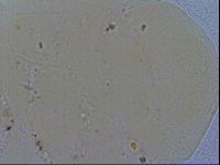 Echiniscus quadrispinosus image