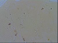 Echiniscus quadrispinosus image