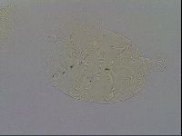 Echiniscus quadrispinosus image
