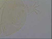 Echiniscus quadrispinosus image