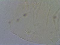 Echiniscus quadrispinosus image