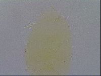 Echiniscus quadrispinosus image