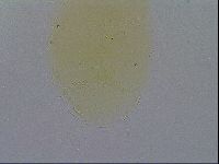 Echiniscus quadrispinosus image