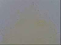 Echiniscus quadrispinosus image