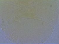 Echiniscus quadrispinosus image