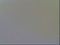 Echiniscus quadrispinosus image