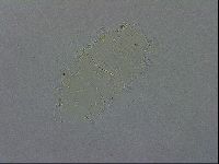 Echiniscus quadrispinosus image