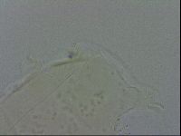 Echiniscus quadrispinosus image