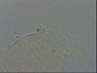 Echiniscus quadrispinosus image