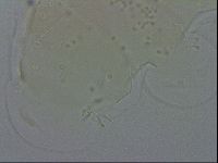 Echiniscus quadrispinosus image