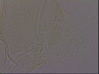 Echiniscus quadrispinosus image