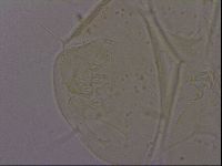 Echiniscus quadrispinosus image