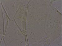 Echiniscus quadrispinosus image