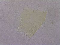 Echiniscus quadrispinosus image