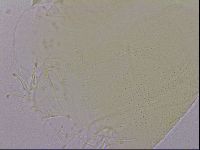 Echiniscus quadrispinosus image