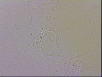 Echiniscus quadrispinosus image