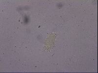 Echiniscus quadrispinosus image