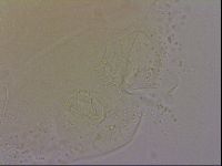 Echiniscus quadrispinosus image