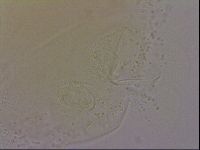 Echiniscus quadrispinosus image