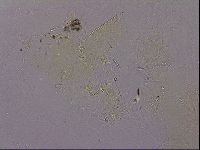 Echiniscus quadrispinosus image