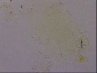 Echiniscus quadrispinosus image