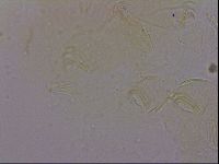 Echiniscus quadrispinosus image