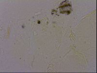 Echiniscus quadrispinosus image