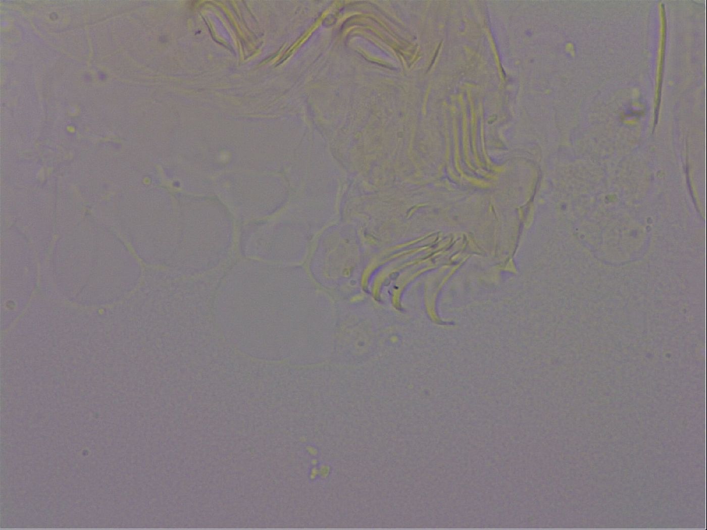 Echiniscus quadrispinosus image