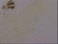 Echiniscus quadrispinosus image