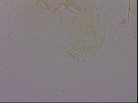 Echiniscus quadrispinosus image