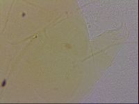 Echiniscus quadrispinosus image