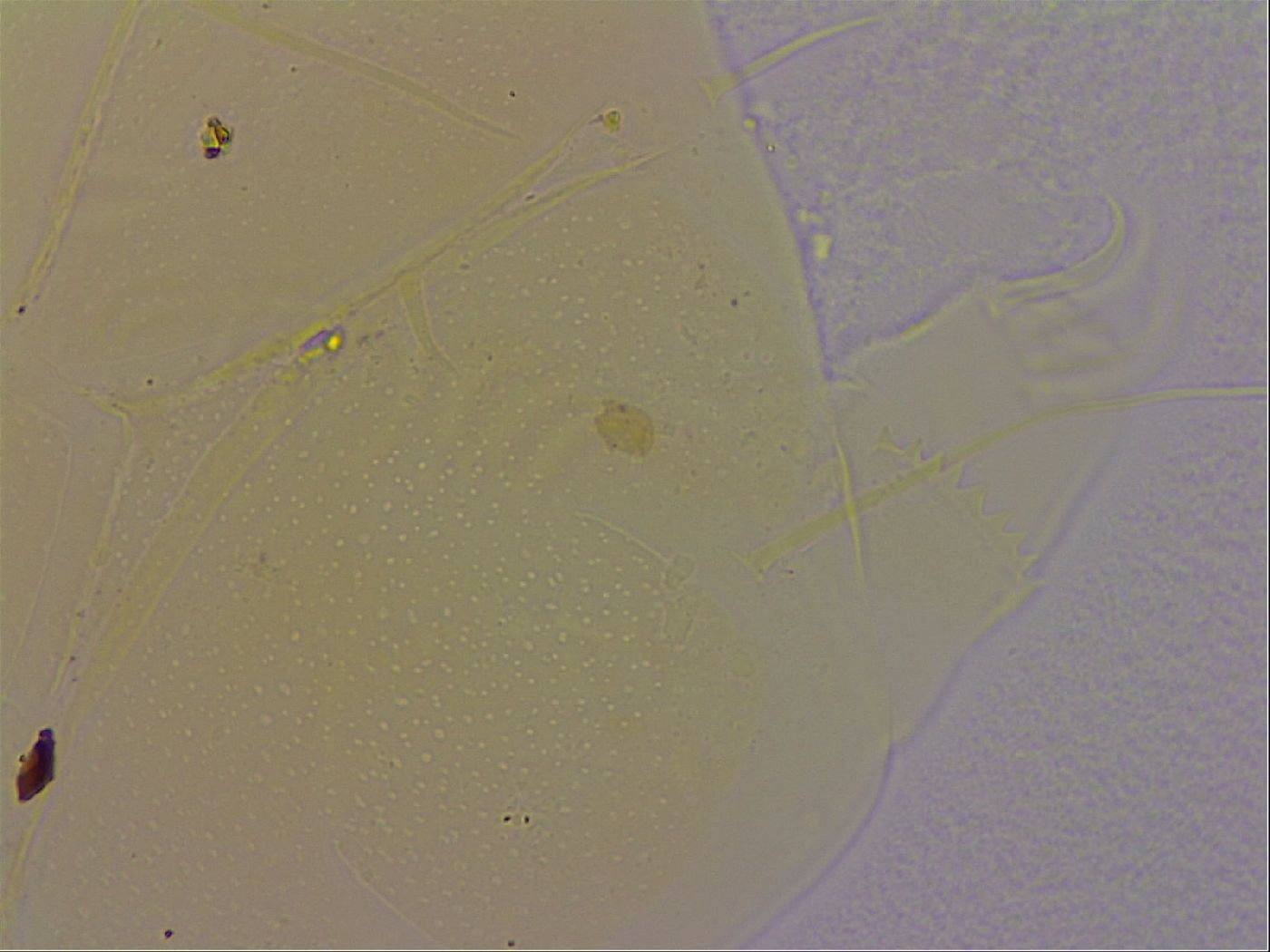 Echiniscus quadrispinosus image