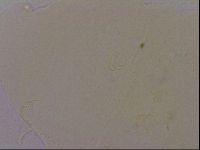 Echiniscus quadrispinosus image