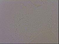Echiniscus quadrispinosus image
