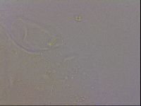Echiniscus quadrispinosus image