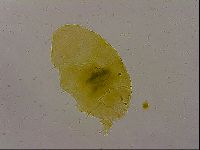 Echiniscus quadrispinosus image