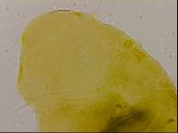 Echiniscus quadrispinosus image