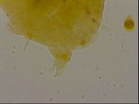 Echiniscus quadrispinosus image