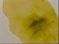 Echiniscus quadrispinosus image